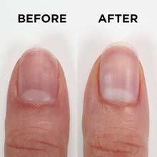 Load image into Gallery viewer, Orly Treatment - Nailtrition